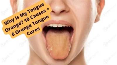 Why Is My Tongue Orange Every Morning?
