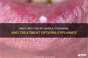 Why Is the Top of My Lip Red?