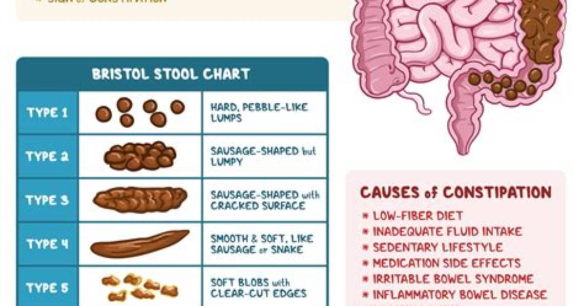 Why Poop Keeps Coming out After Wiping?