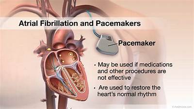 Will a Pacemaker Help Afib?