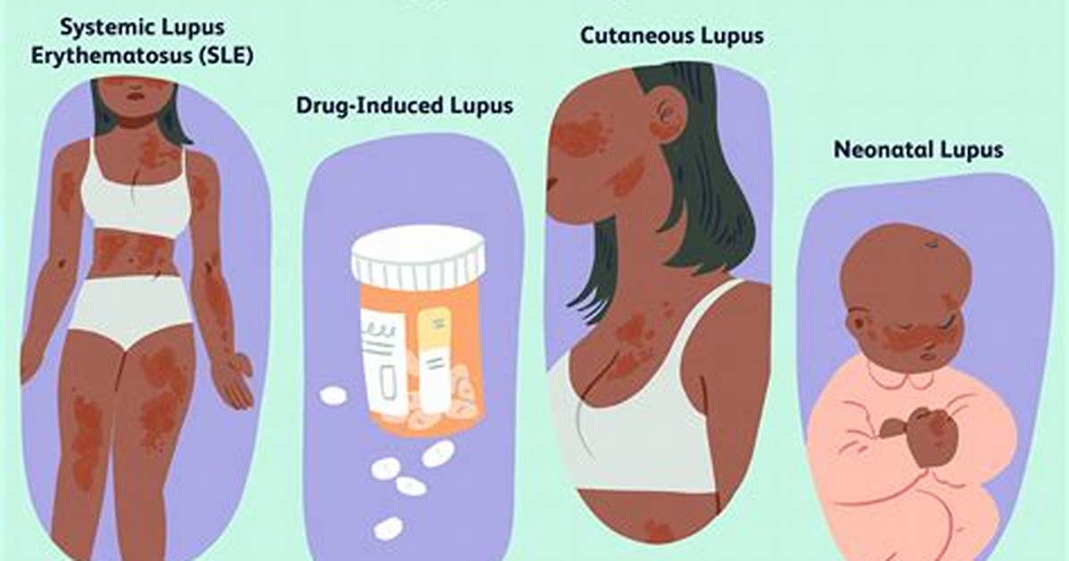 Will an Autopsy Show Lupus?