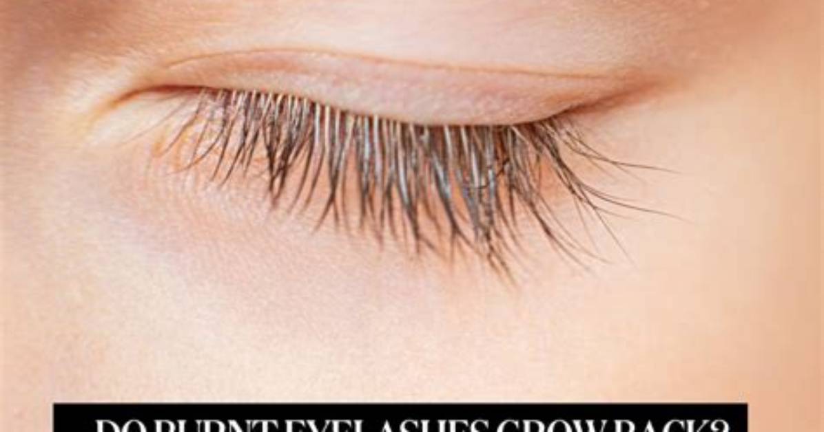 Will Burnt Eyelashes Grow Back?