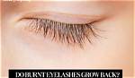 Will Burnt Eyelashes Grow Back?