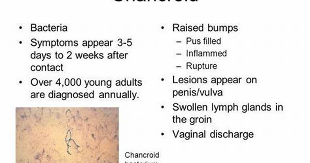 Will Chancroid Go Away?