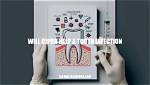 Will Cipro Help a Tooth Infection?
