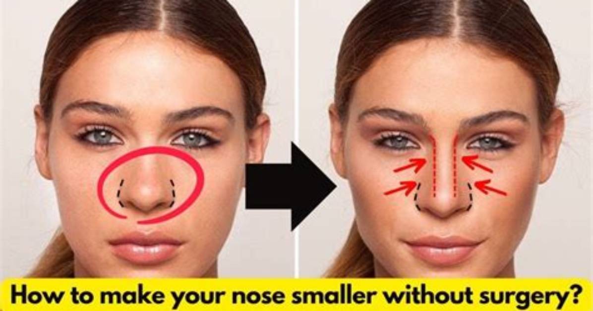 Will My Nose Get Smaller?