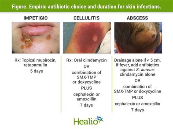 Will Skin Infections Clear Without Antibiotics?