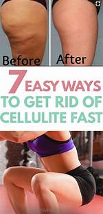 Will Spin Class Get Rid of Cellulite?
