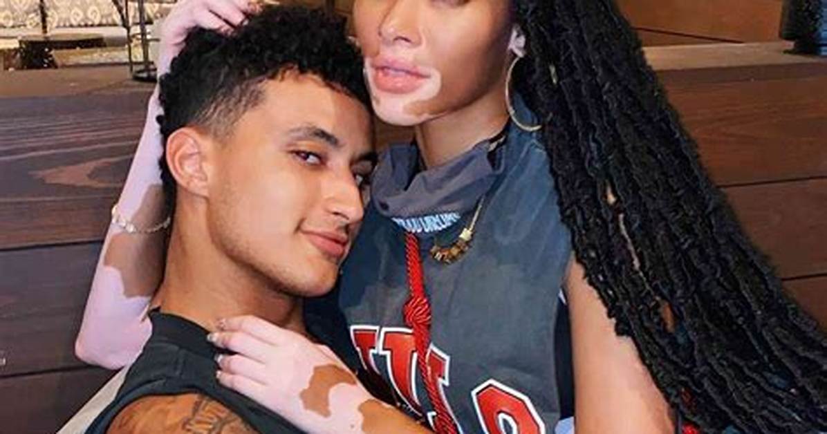 Winnie Harlow and Kyle Kuzma: a Love Story Worth Exploring