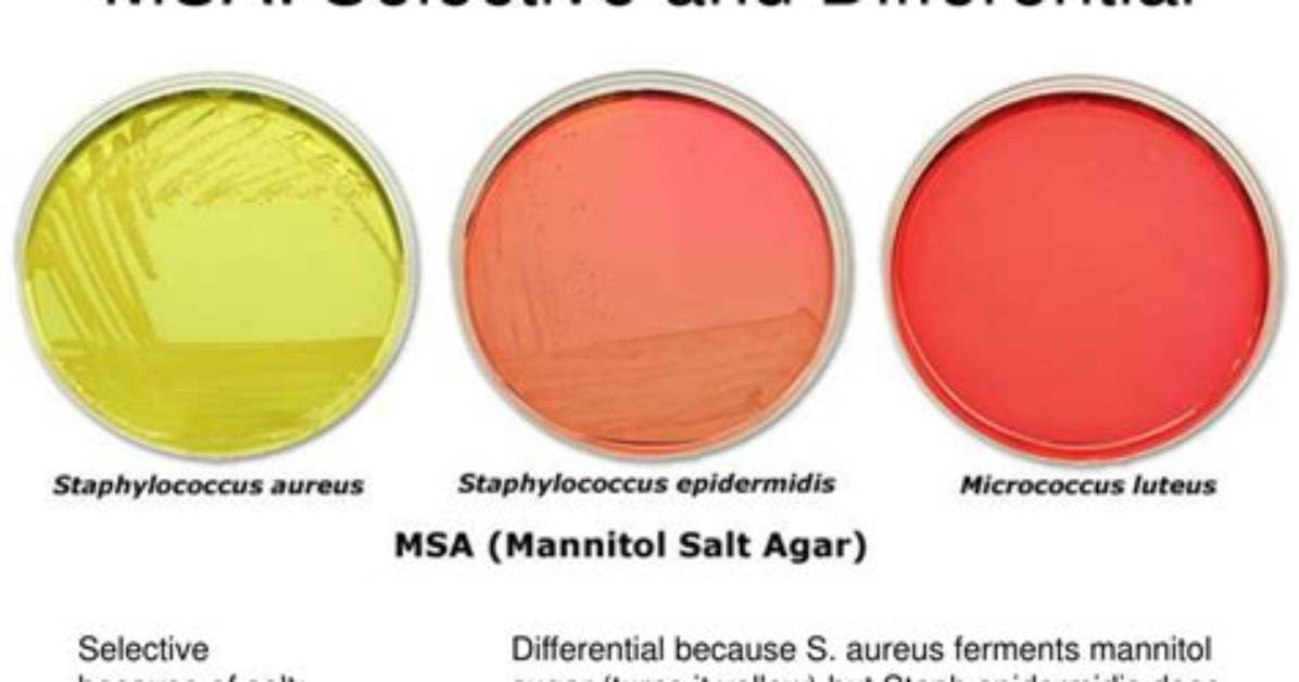 Would Msa Medium Still Be Selective and Differential for Staphylococcus Aureus If It Did Not Have Salt in It?