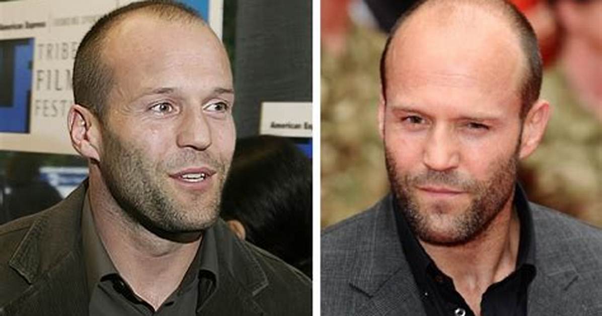 Young Balding Celebrities