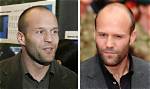Young Balding Celebrities