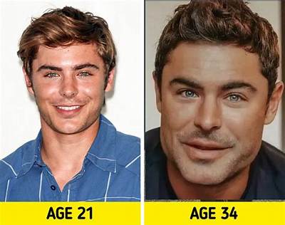 Zac Efron Plastic Surgery Video, Before & After Photos in 2022 – Has He Gotten Cosmetic Surgery?