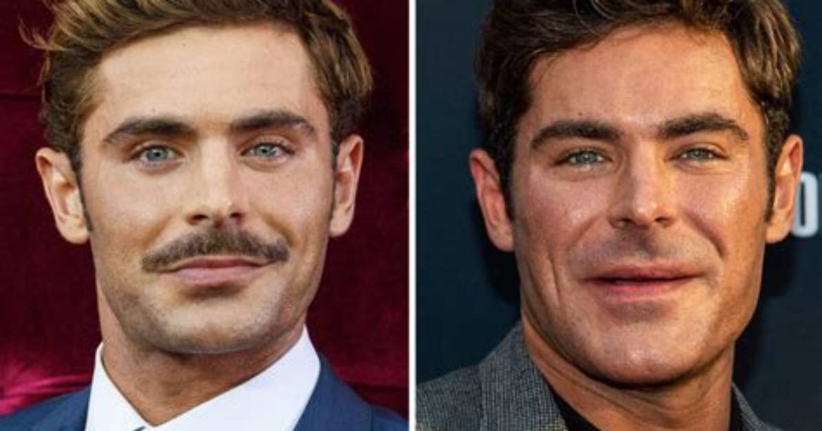 Zac Efron's New Face: a Transformation Unveiled